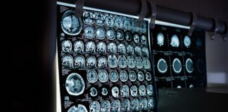 Czy rezonans magnetyczny wykaże że chorujemy na choroby psychiczne?